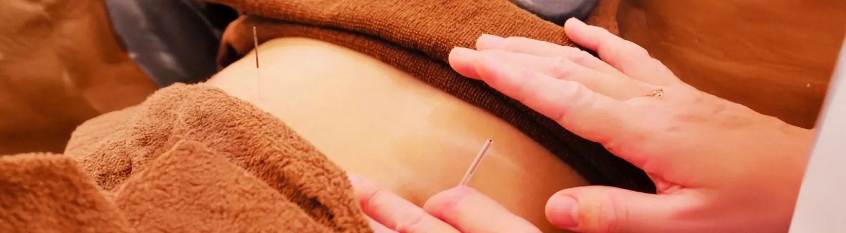 経験豊富なスタッフが施術を担当