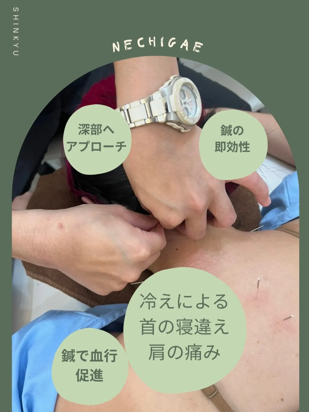 【新年を健康に！鍼灸で冬の寝違えを解消】