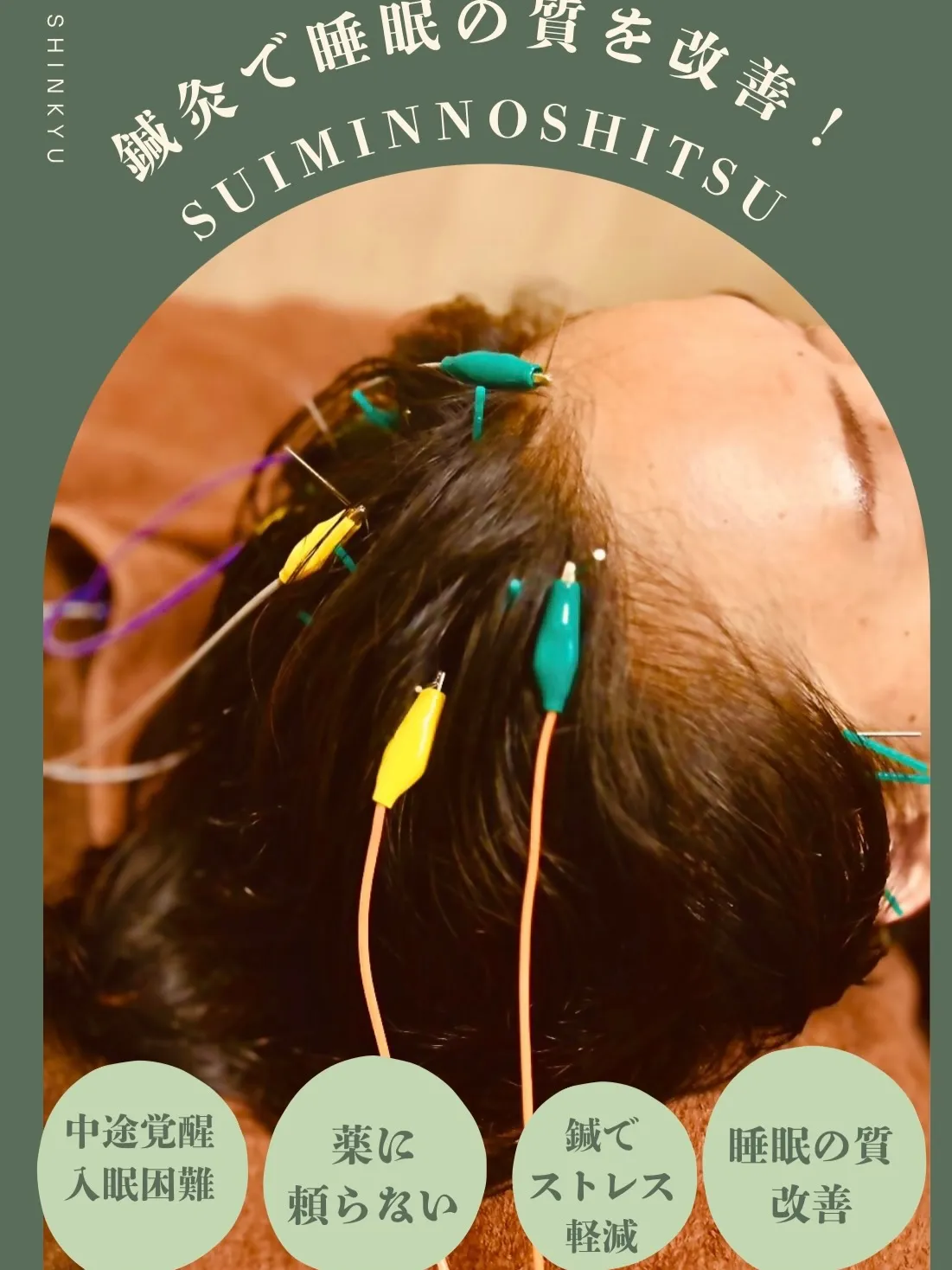 【 鍼灸で睡眠の質を改善！薬に頼らない自然なアプローチ】