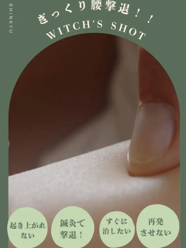 【ギックリ腰を鍼灸で早期撃退】